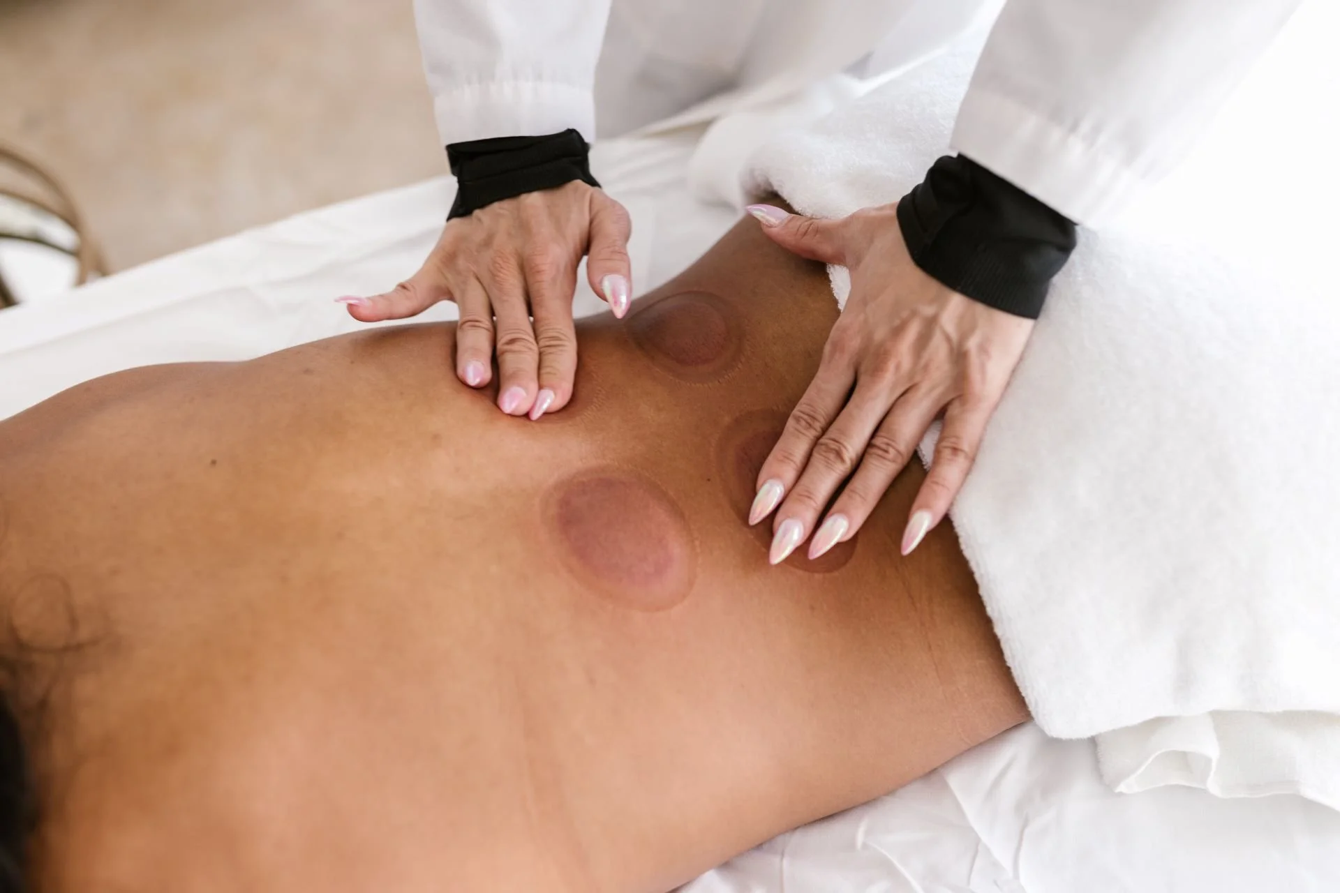 Cupping Therapy in Massage: Ancient Practice, Modern Benefits - APersonMassagingaVentosaCupMarksonaPatient27sBack 1